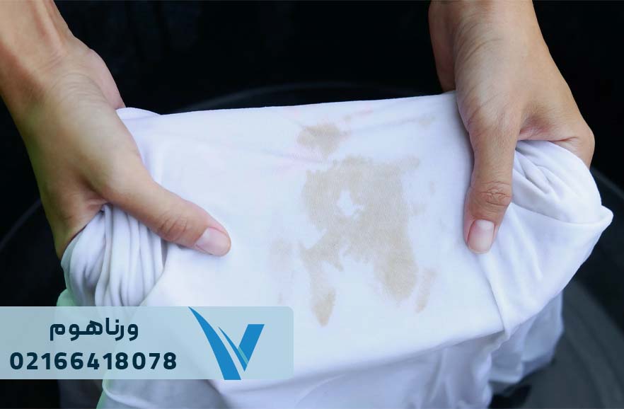 روش های ازبین بردن لک و چرک مردگی ملحفه و روتختی