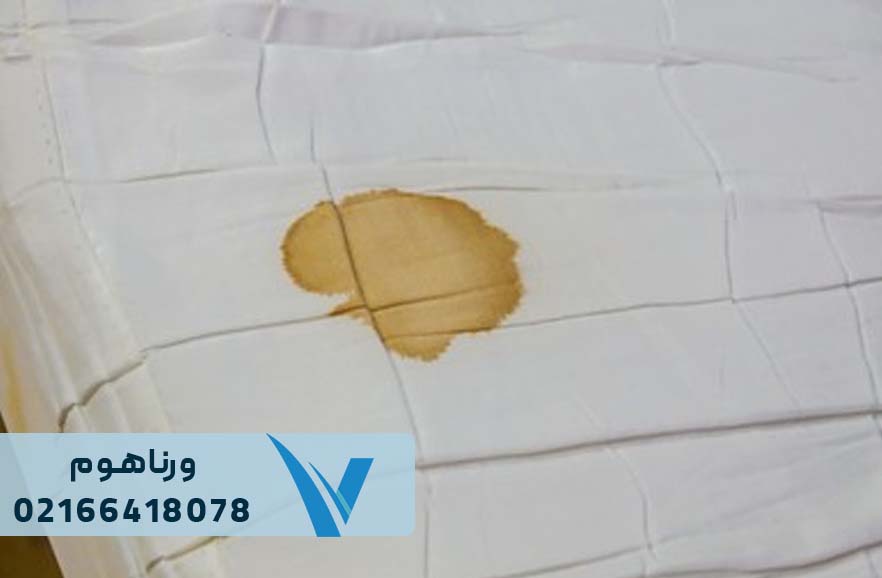 روش های ازبین بردن لک و چرک مردگی ملحفه و روتختی