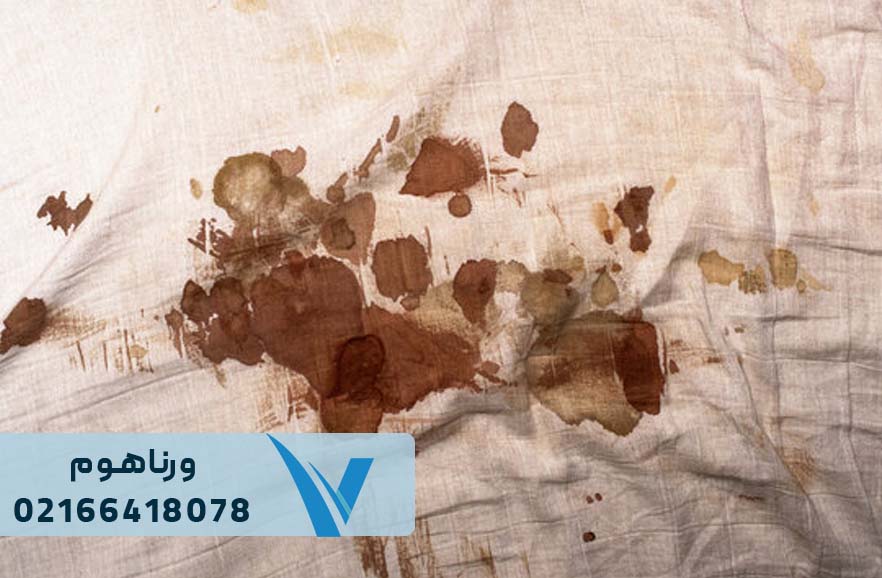 روش های ازبین بردن لک و چرک مردگی ملحفه و روتختی